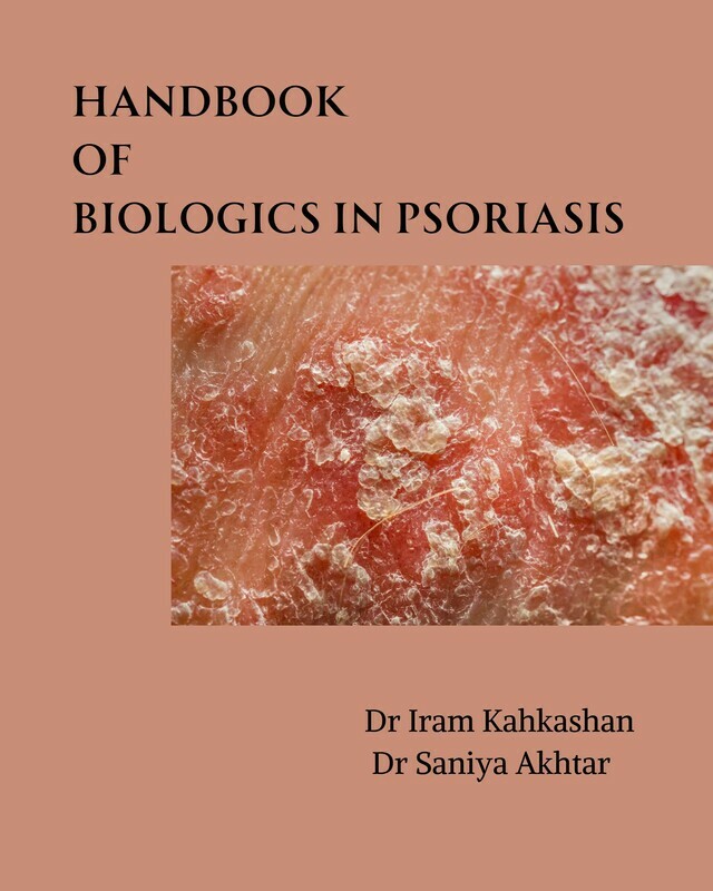 Handbook of Biologics in Psoriasis