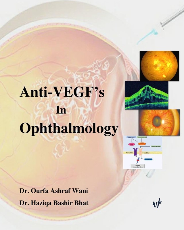 Anti-VEGF’s In Ophthalmology