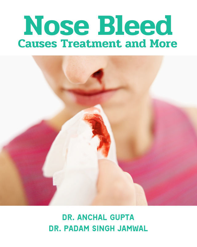 Nose Bleed - Causes Treatment and More
