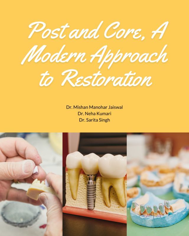 Post and Core, A Modern Approach to Restoration